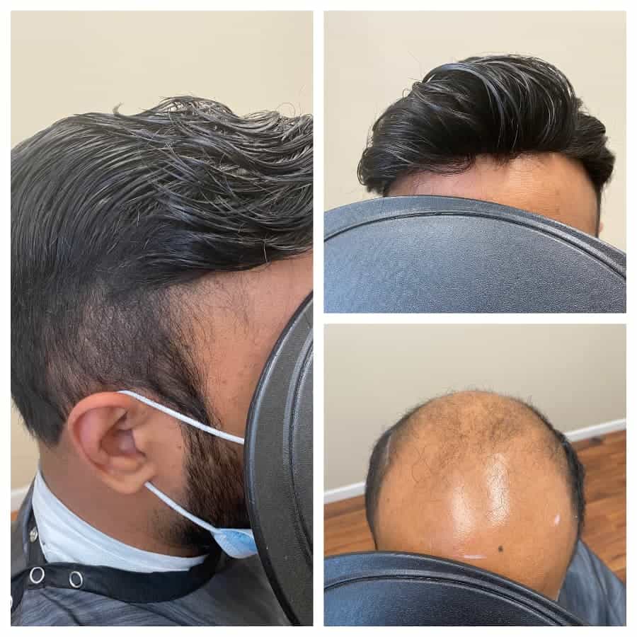 The Incredible hair pieces- toupee for men, sense all the charm
